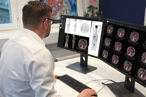 hermes molecular imaging software.